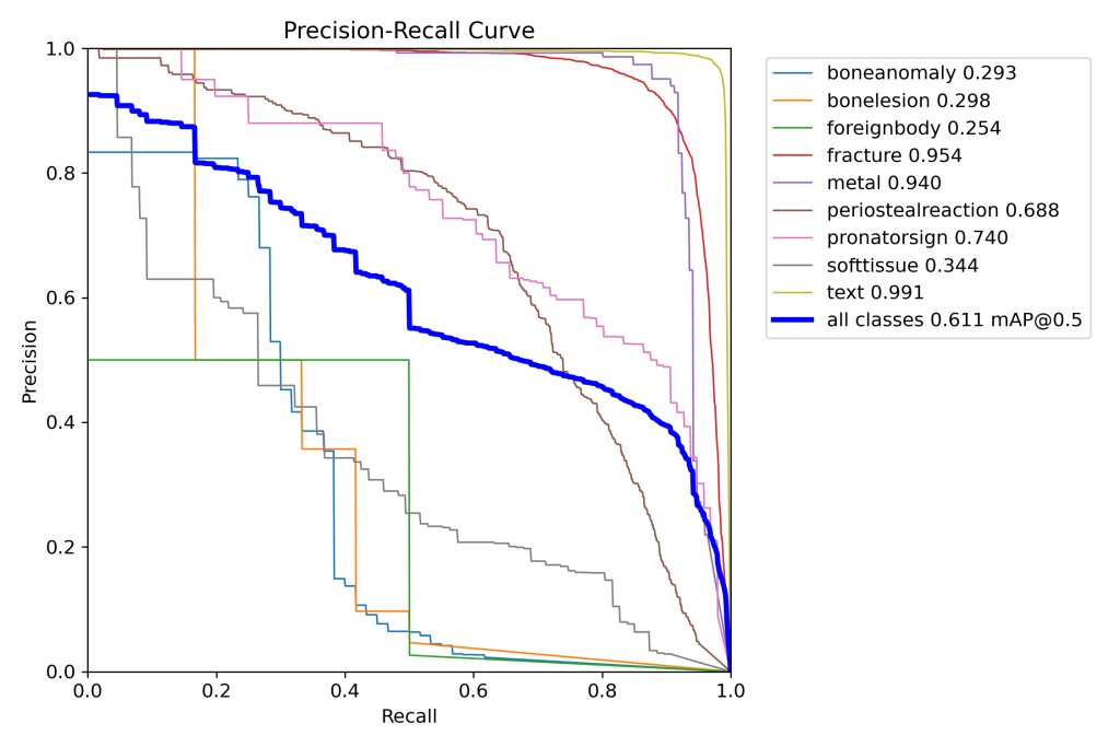 基于深度学习YOLOv8和YOLOv5的骨折检测骨折识别老人骨折儿童骨科诊断系统-创享日记