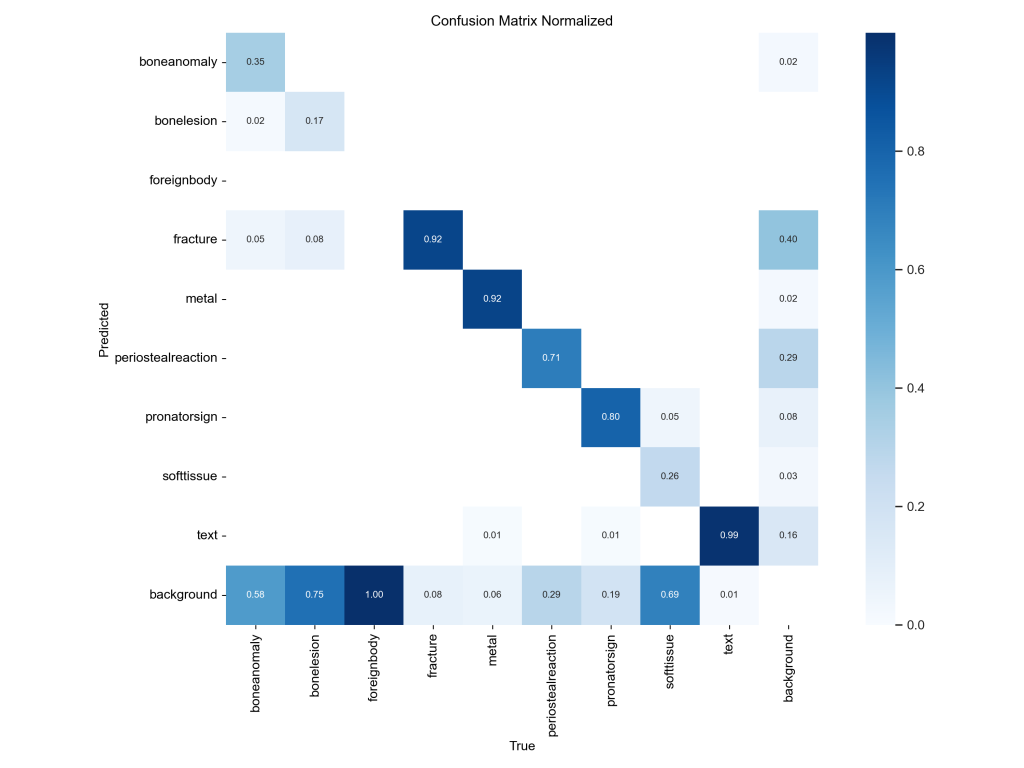 基于深度学习YOLOv8和YOLOv5的骨折检测骨折识别老人骨折儿童骨科诊断系统-创享日记